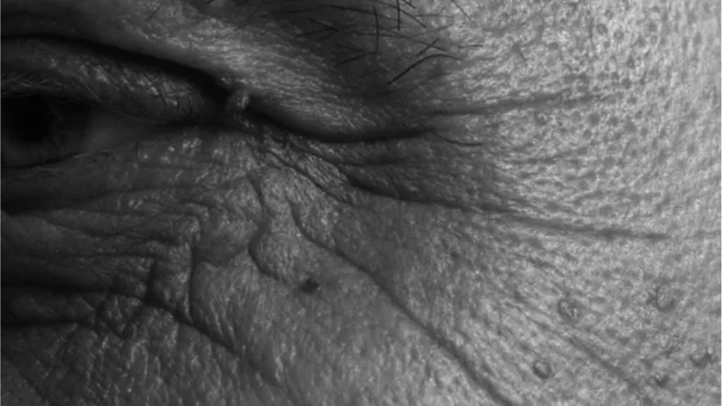 blog_-_como_escolher_a_tecnica_certa